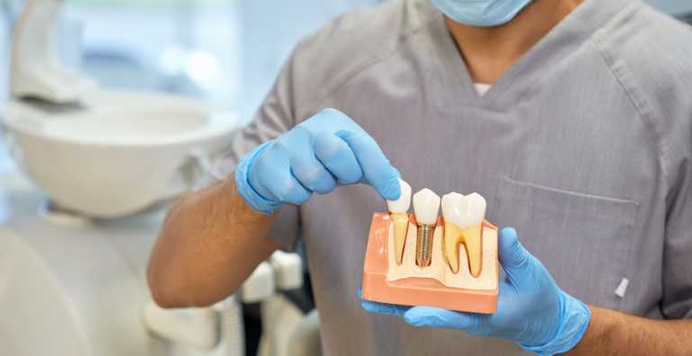 Dental Implants - best dental care in usa - dental quest lowell