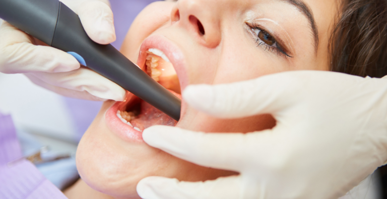 Root Canals - best dental care in usa - dental quest lowell