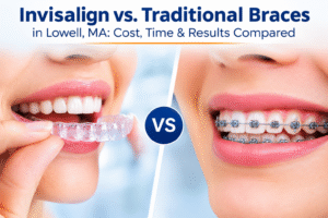 Invisalign vs. Braces in Lowell, MA